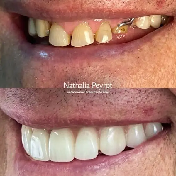 Publicação de @nathipeyrot.dentista em 29 jul