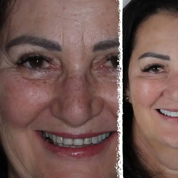 Publicação de @nathipeyrot.dentista em 6 ago