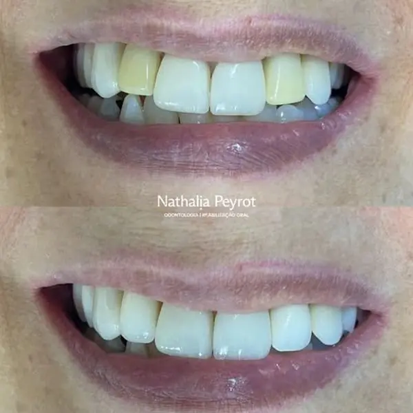 Publicação de @nathipeyrot.dentista em 20 ago